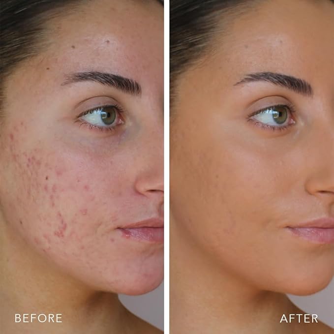 Doll 10 TCE Liquid Filter - Covers, Blurs, and Brightens (Fair/Light)