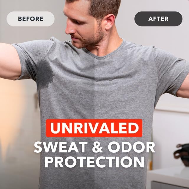 SweatBlock Antiperspirant Wipes - Maximum Clinical Strength - Treat Hyperhidrosis & Excessive Sweating for Men, Women, & Teens - up to 7 Days Protection Per Wipe - Dermatologist Tested - 30 Wipes