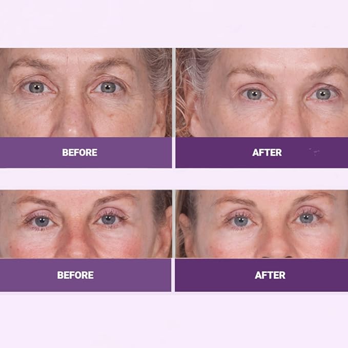 Serious Skincare INSTA-TOX Facial Firming Wrinkle Smoothing Serum and Reverse Lift Firming Eye Cream Set - Filler for Fine Lines, Deep Wrinkles and Pores - Temporary Eye Tightener