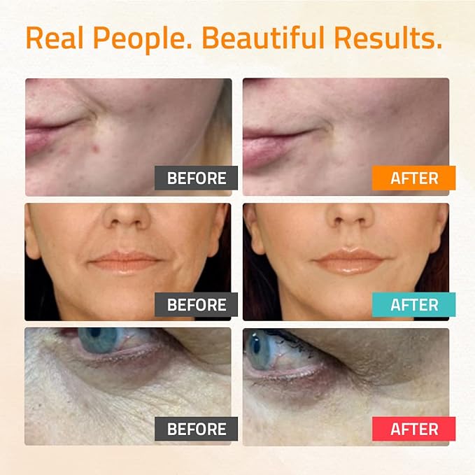 YEOUTH Skin Care Set: Retinol Serum for Face, Vitamin C and Hyaluronic Acid Serum, Face Care Kit that Targets Appearance of Uneven Uneven Skin and Dryness 3x1 oz