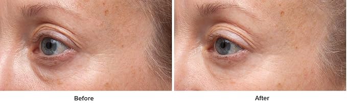 Dr. Dennis Gross Ferulic + Retinol Triple Correction Eye Serum: for Wrinkles, Loss of Elasticity, and Rough Texture, 0.5 fl oz