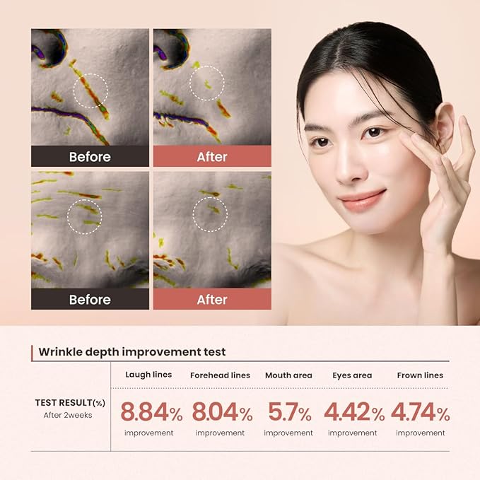 Lifting Serum – 15ml (0.5 fl oz) – Visibly Firms Skin, Reduces Wrinkles, Tightens Pores, Deep Hydration with Peptides & Caffeine