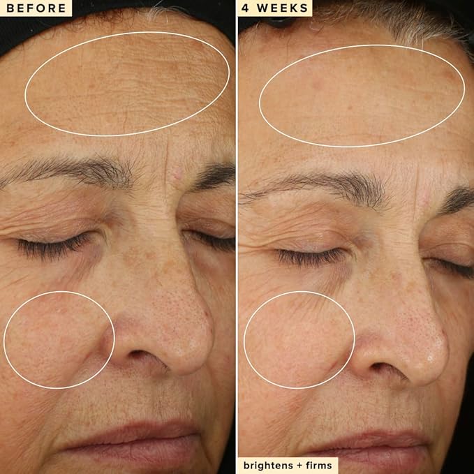 Farmacy 10% Vitamin C Serum for Face - Brightening Vitamin C Face Serum to Firm + Smooth Skin Texture - L Ascorbic Acid + Tangerine Peel Infused Skin Care to Hydrate and Even Skin Tone (30ml)