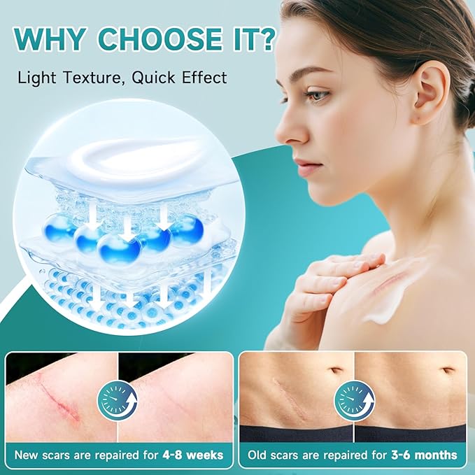 Advanced Scar Cream, Silicone Gel for Scars, Professional Scar Removal Cream for Surgical Scars, Stretch Marks, Old and New Scars 1.7 oz(50ml)