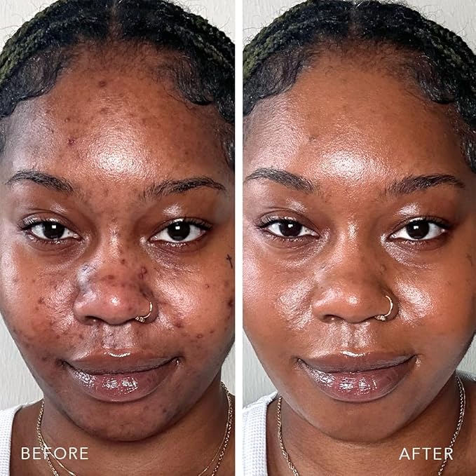 Doll 10 TCE Liquid Filter - Covers, Blurs, and Brightens (Deep/Rich)