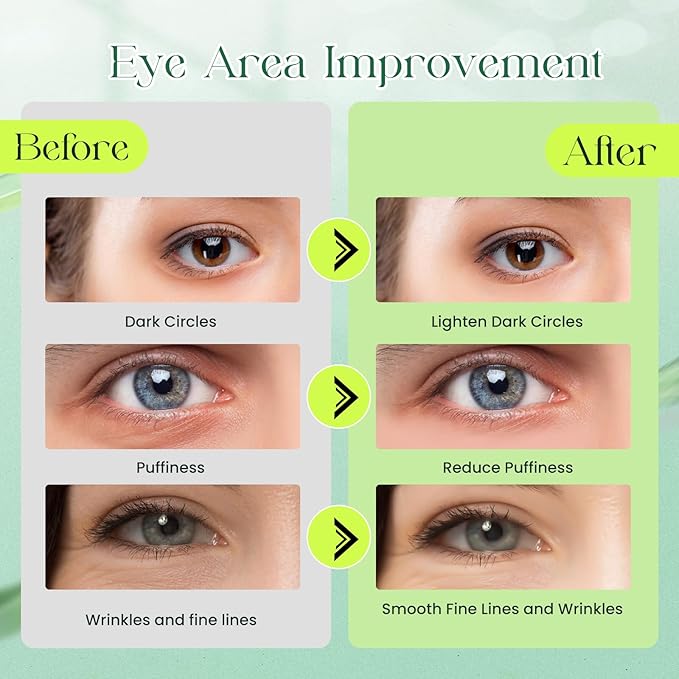 60 Pack Avocado Extract Eye Masks,Hyaluronic Acid Augenpads,Moisturising Eye Mask,Remove Dark Circles,Tear Bags,Wrinkles,Puffiness,Suitable for All Skin Types