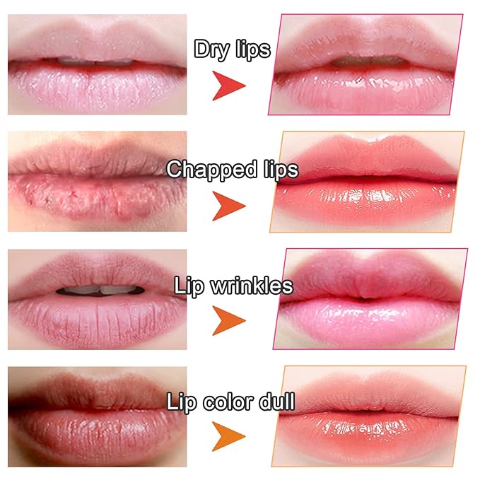 Adofect 30 Pieces Collagen Crystal Lip Masks, Collagen Lip Pads Great for Moisturizing, Remove Dead Skin, Anti Chapped & Anti-Aging and Plump Your Lips, Watermelom Red