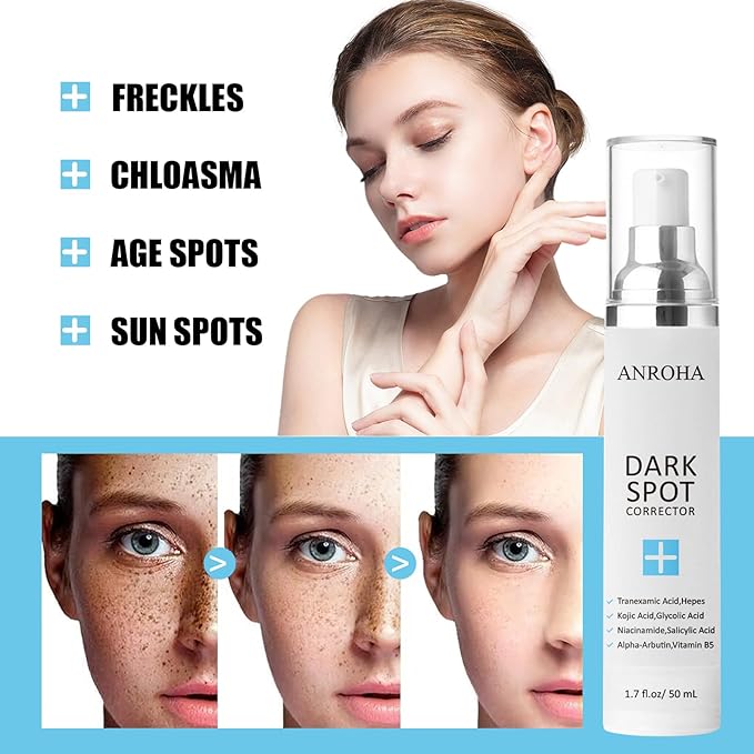 Dark Spot Remover for Face and Body Serum Promotes Anti-Aging Effect -Dark Spot Corrector for Women and Men with Niacinamide Kojic Acid & Salicyic Acid 50ml /1.7fl oz