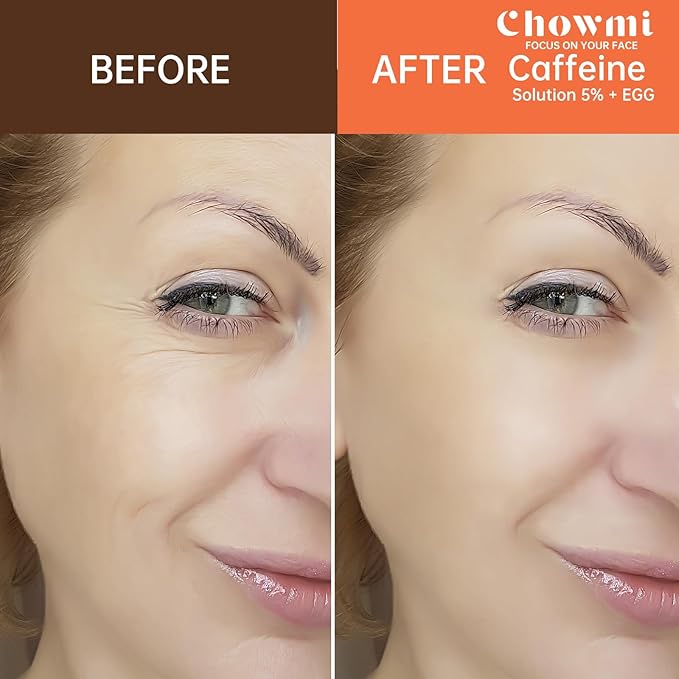 The Caffeine Solution 5% + EGCG，Reduces Appearance of Eye Contour Pigmentation and Puffiness，Under Eye Serum (30ml) Caffeine For Face Moisturizing Serum (2)