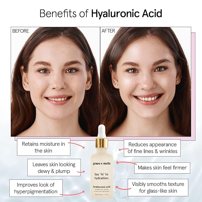 grace & stella Award Winning Hyaluronic Acid Serum (10ml/0.34 fl oz) Hyaluronic Acid Serum for Face - Acido Hialuronico Face Serums for Women - Hydrating, Remove Fine Lines, Wrinkles - Anti Aging