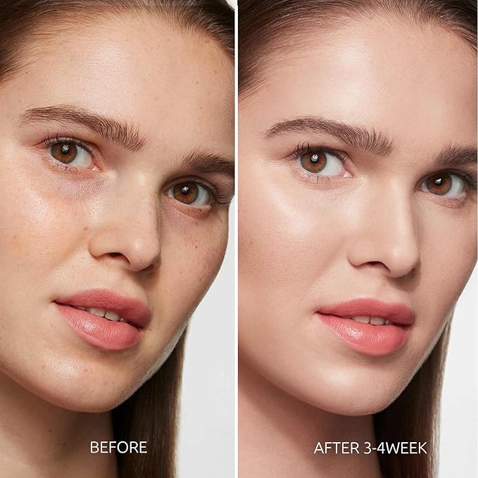 Dark Spot Remover for Face and Body - Dark Spot Corrector for Face - Sun Spots, Age Spots, Freckles & Melasma Remover - Brown Spot Corrector Evens Skin Tone for All Skin Type 1.7 Fl Oz