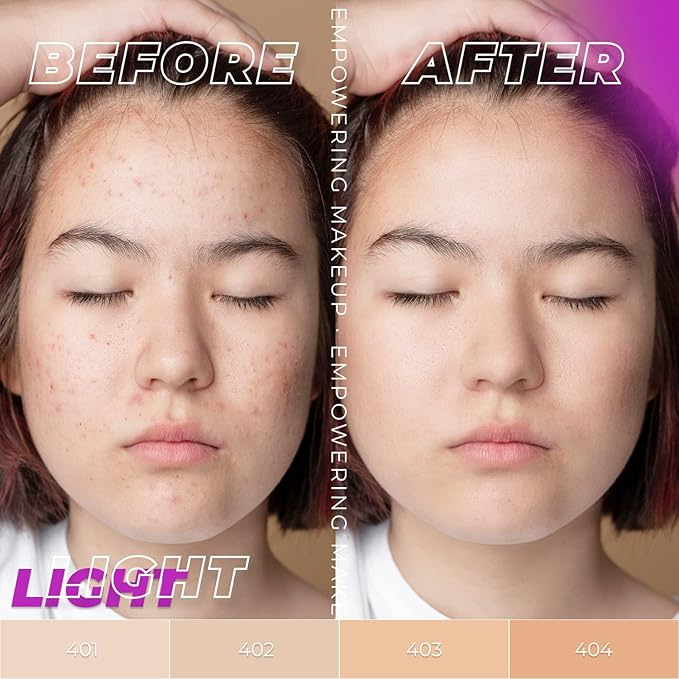 LAMEL OhMy Clear Face Full Coverage Foundation - Acne Coverage - Salicylic Acid & Tea Tree Extract - Dewy & Flawless Finish - Sensitive Skin Care - Organic & Oil-Free - 401, 1.35 fl.oz