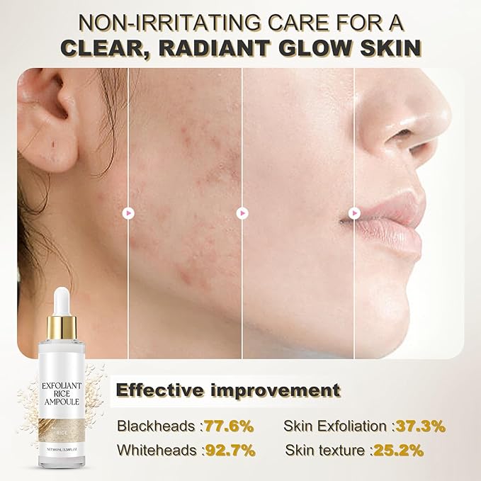 Peel Shot White Rice Peeling Ampoule - Soft Exfoliating Face and Body Scrub - Rice Exfoliator for Face Dead Skin Remover for Body - Deep Pore Cleanser Facial Scrub Exfoliator for All Skin Types