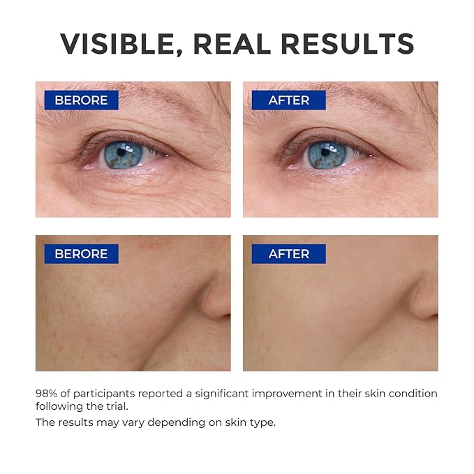 Retinol Serum for Face, Anti Aging Serum, Retinoid Collagen with Vitamin E Resurfacing Facial Rapid Fine Lines Repair, Brightening Pore Minimizer for Face Daily Skin Care Treatment 1oz