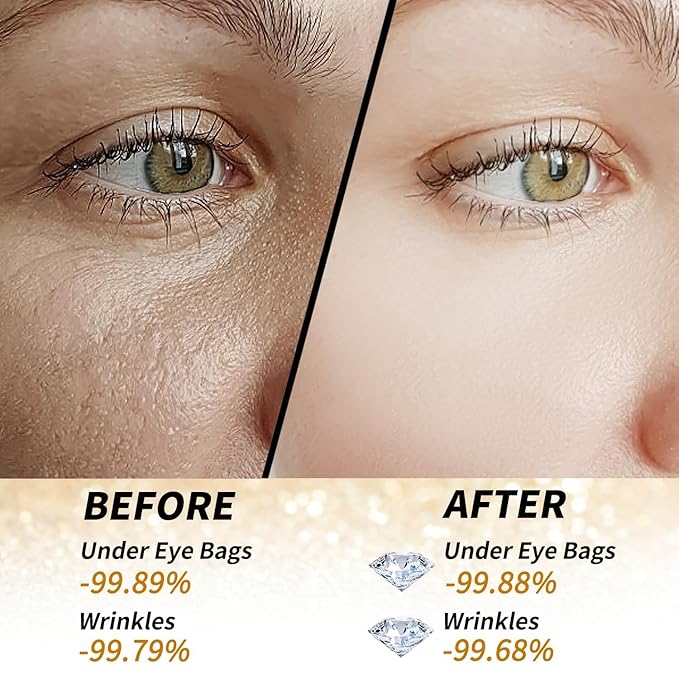 24k Gold Under Eye Patches - 60 Pcs Eye Mask Pure Gold Anti-Aging Collagen Hyaluronic Acid Under Eye Mask for Dark Circles, Puffiness & Wrinkles Refresh Your Skin