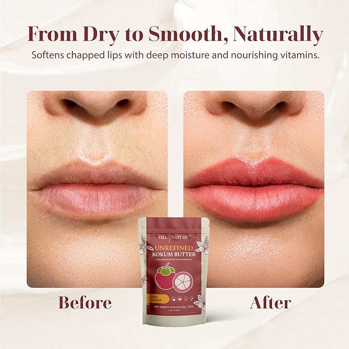 era of nature Kokum Butter Raw - 8 oz (1/2lb) – Natural Butter for Body Butters, Lotion Bars, Lip Balm, Soap Making – Blends Well with Shea or Cocoa Butter – For Stretch Marks, Scars, Pregnancy Care