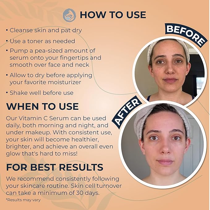 Vitamin C Face Serum - Anti Aging & Brightening Facial Serum - With Hyaluronic Acid Gotu Kola & Jojoba Oil - Natural & Organic - Foxbrim Naturals 1oz