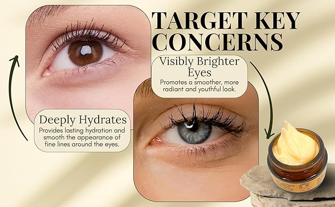 Anti-Aging Eye Cream with Squalane, Nicotinamide, and Panthenol (B5) for Dark Circles, Puffiness, and Fine Lines - 1oz