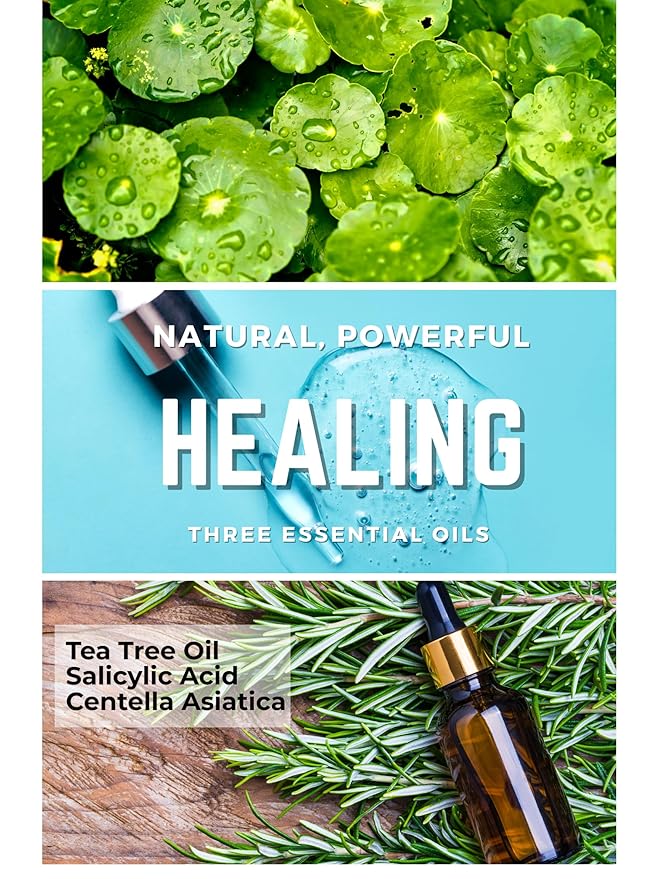 Acne Patch Ultra Thin Invisible Spot Cover- Fast Acting Hydrocolloid Pimple Patch with Salicylic Acid, Centella Asiatica & Tea Tree Oil- 72 Ct. Effective Treatment Absorbs Zits and Blemishes