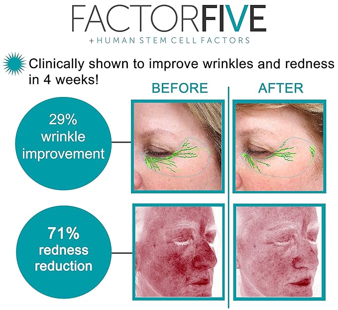 Age Defying Cream with Stem Cell Growth Factors for Anti-Wrinkle, Collagen Boost, and Acne Scarring Repair, Large Size, 1fl oz/30ml